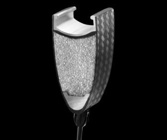 Here you can see the aluminium rim bed and spoke inserts